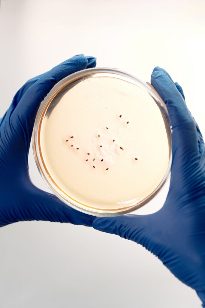 argile verte microbiote et smectite comme support bactérien